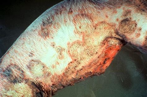 Pityriasis Rosea in Pigs - Merck Veterinary Manual