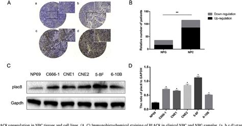 Placenta specific 8 gene induces epithelial-mesenchymal …