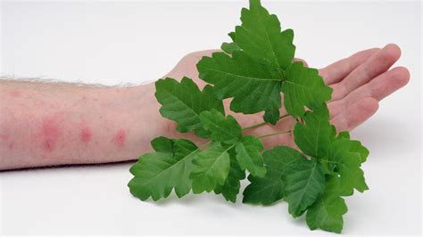 Plant used to treat rashes crossword clue. Rashes Crossword Clue Answers. Find the latest crossword clues from New York Times Crosswords, LA Times Crosswords and many more. Enter Given Clue. ... *Plant used to treat rashes 24% 4 ALOE: Plant used to treat rashes By … 