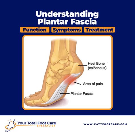 Plantar Fasciiitis & K Laser Therapy Laser Therapy OC