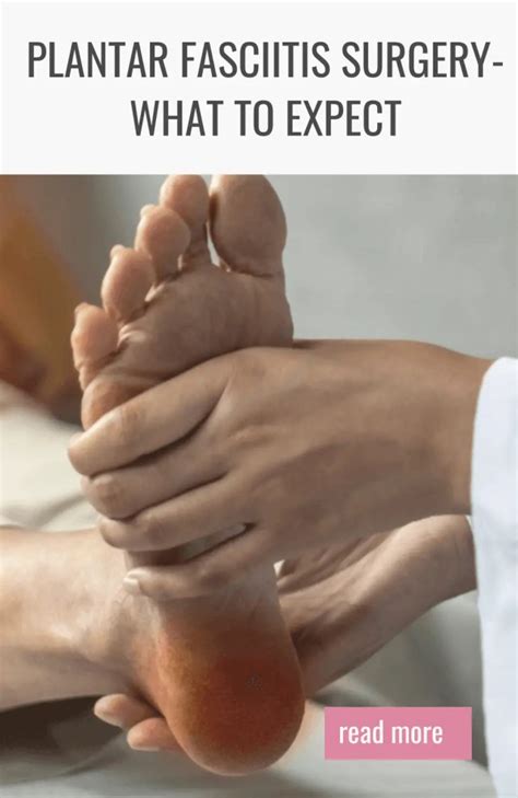Plantar Fasciitis Surgery What to Expect