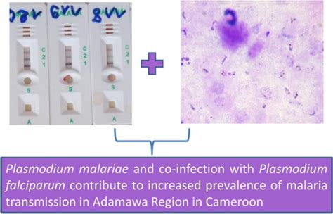 Plasmodium malariae contributes to high levels of malaria …