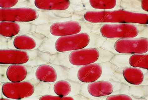 Plasmolysis in Onion Epidermal Cells - Biology Lab Techniques