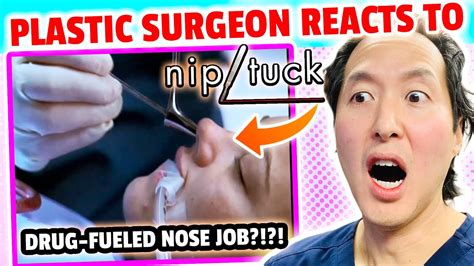 Plastic Surgeon Reacts to NIP/TUCK! Collapsed Nose Due to …