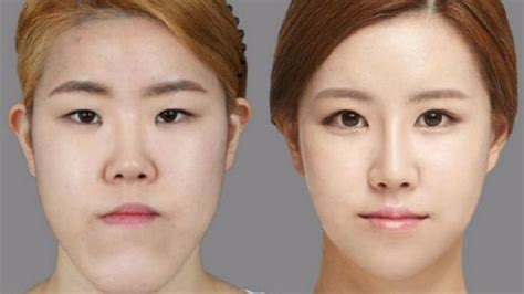 I don't trust knetz on Pann for plastic surgery lol they thought 