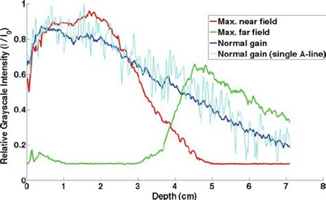Plots of the ultrasound signal intensity as a function of depth can be