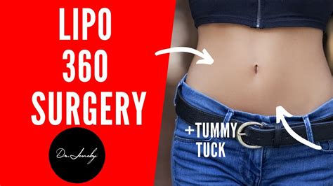 Tummy Tuck (Abdominoplasty) Overview: Cost, Recovery, Before