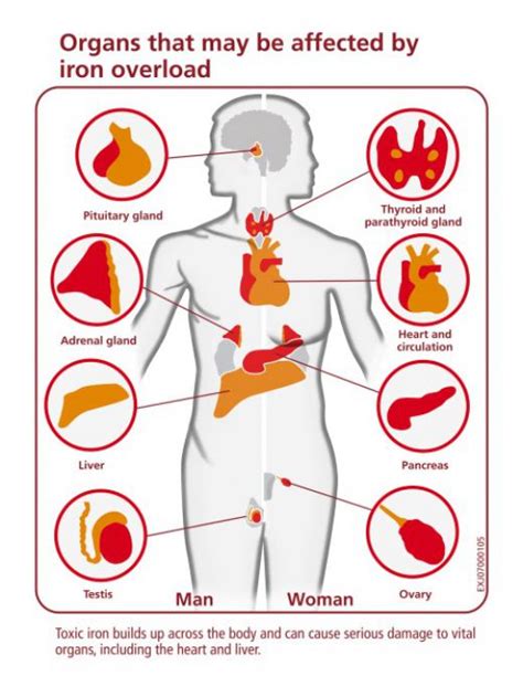 Poisoning - Iron - rph.health.wa.gov.au