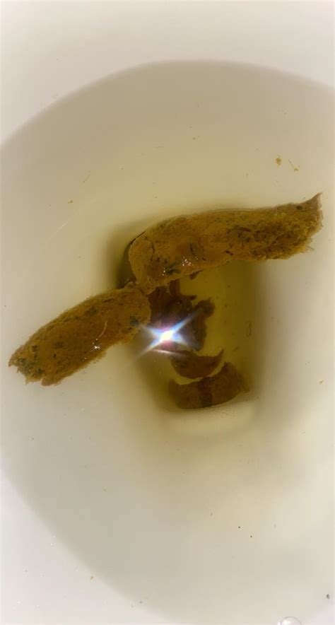 Poop with black spots. Black spots in stool I take a fiber supplement once a day I had a little diarrhea yesterday so I think this might just be undigested food but don’t know for sure Share Add a Comment. Be the first to comment Nobody's responded to this post yet. Add your thoughts and get the conversation going. ... 