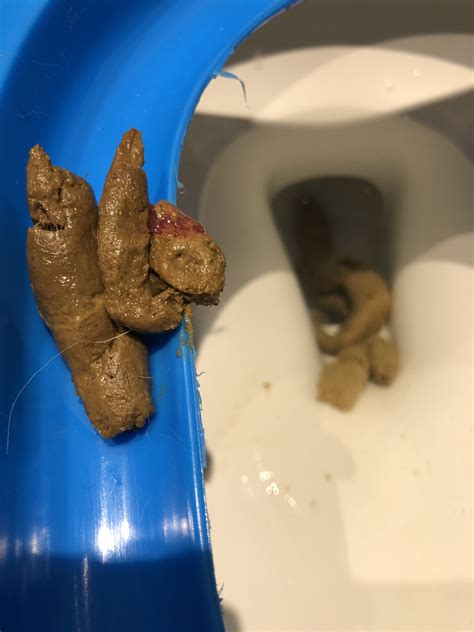 Pooping blood after taking antibiotics. Black, tarry feces can also be a sign of intestinal bleeding or bleeding from the stomach. Straining during bowel movements can also lead to inflammation of the rectum and anus, and blood in the stool. That said, sometimes your dogs stool may be red from something hes eaten that has red dye. 