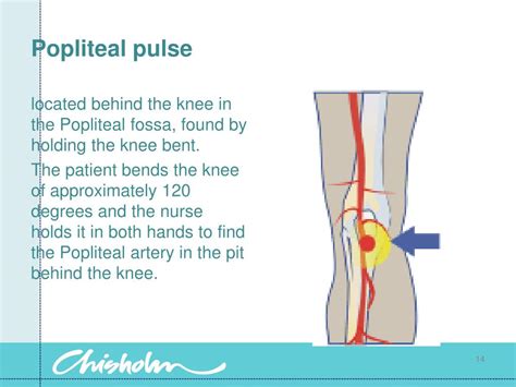 Popliteal artery pulsation. The variations were also classified under the standardized popliteal artery variants. Conclusions: The arterial variations are embryological imprints. Knowing them provides great help for vascular surgeries, flap procedures, managing ischemic or diabetic foot, club foot correction etc. Imaging the vessels before surgery is always advocated. ... Clinically, … 