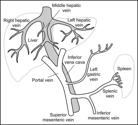 Portal vein thrombosis — Mayo Clinic