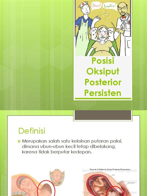 Posisi Oksiput Posterior Persisten [9n0k08850p4v] - idoc.pub