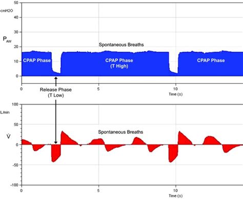 Positive End-Expiratory Pressure - StatPearls - NCBI …