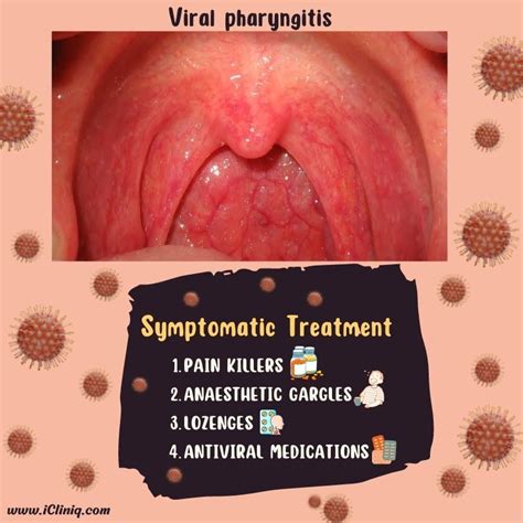 Post Nasal Drip, Sore Throat And Spots On Tonsils