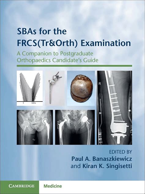 Postgraduate orthopaedics the candidates guide to the frcs tr and orth examination. - Suzuki df 140 hp outboard manual.