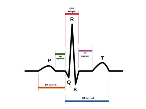 Pqrst wave. Electrocardiogram (ECG) is a simple and fast test that provides the graphical representation of the electrical signal obtained by the heart’s activity and is widely employed to detect functional heart conditions. Indeed, its segmentation and feature extraction are required to produce a diagnosis. This paper focuses on the development of a segmentation … 