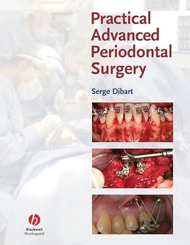 Practical Advanced Periodontal Surgery 1st Edition