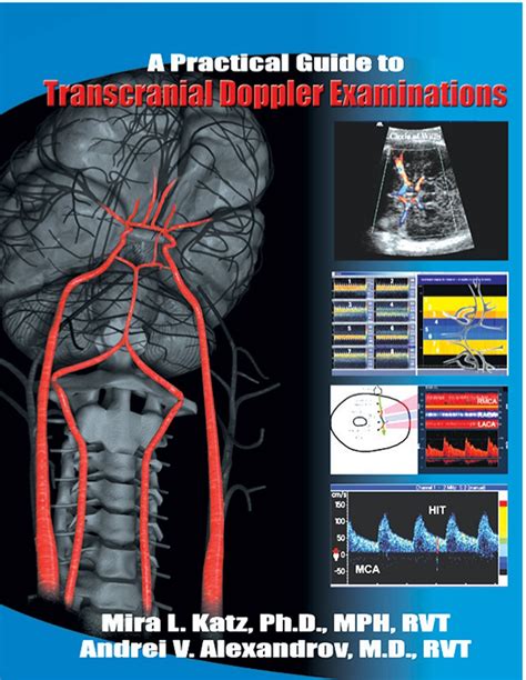 Practical guide to transcranial doppler examinations. - Study guide for content mastery science ch28.