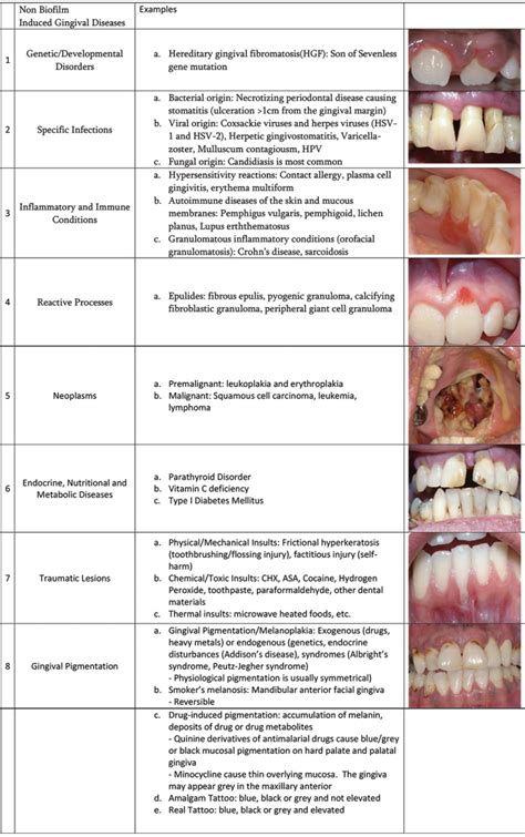 Practical manual of periodontology and periimplantitis. - Carrello elevatore a cingoli manuale ep16kt.