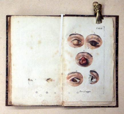 Praktische beobachtungen ©ơber hartn©þckige und eingewurzelte venerische zuf©þlle. - Livro que dá razão do estado do brasil - 1612.
