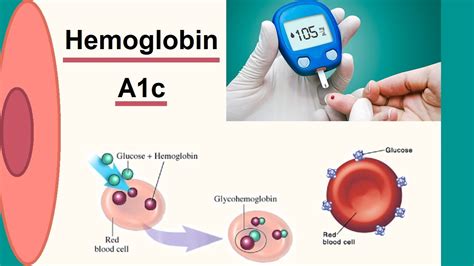 PreDiabetes Detected Effectively Using Hemoglobin A1C