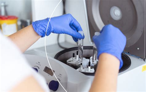 Preconception testing Repromeda