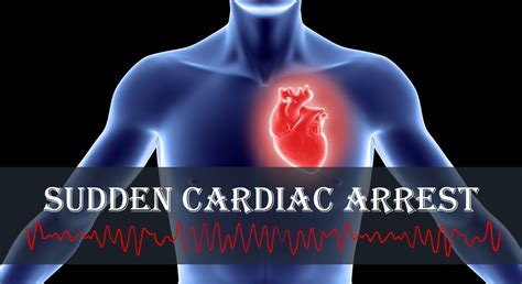 Predicting Sudden Cardiac Arrest