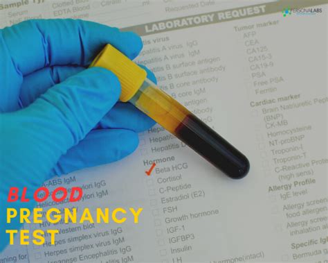 Pregnancy Blood Lab Testing in Houston, TX Personalabs