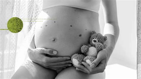 Pregnancy and moles Link and when to seek help