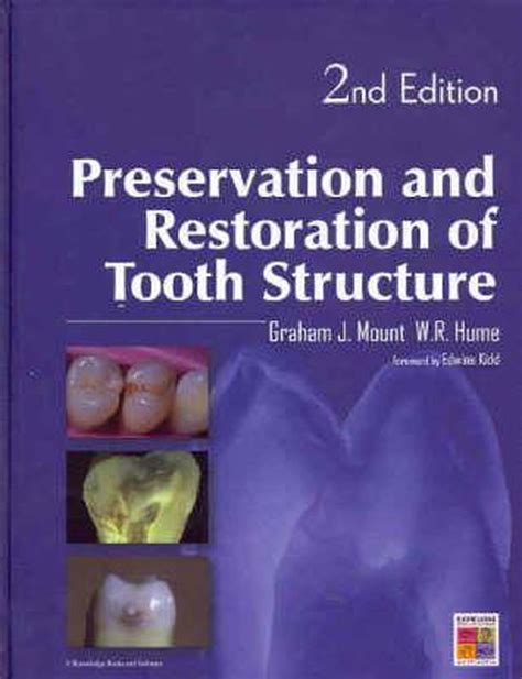 Read Online Preservation And Restoration Of Tooth Structure By Graham J Mount