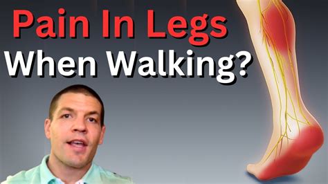 Pressure in legs when walking
