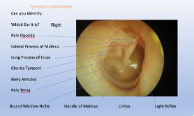 Prevalence of otitis media, hearing impairment and cerumen impaction …