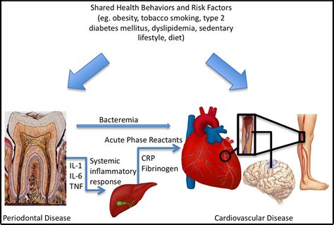 Preventing Systemic Inflammation After Cardiac Surgery With …