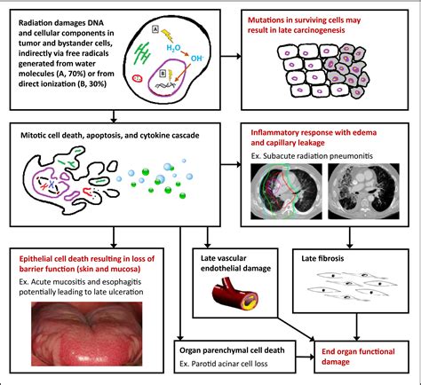 Prevention and Management of Radiation Toxicity - Cancer …