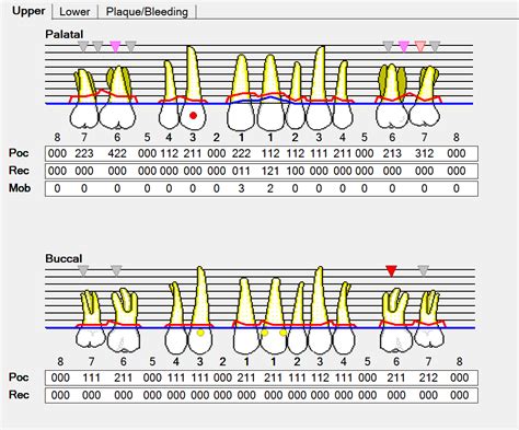 Printable Chart printableperiochart1 Printable Perio Chart Dental