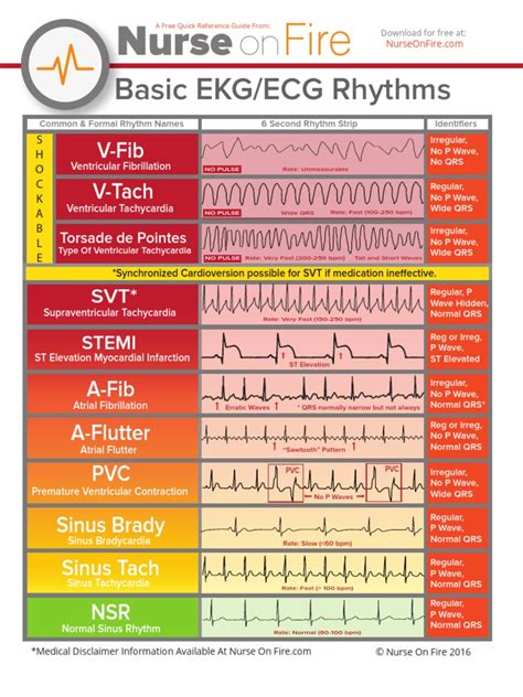 Printable Ekg Cheat Sheet Customize and Print