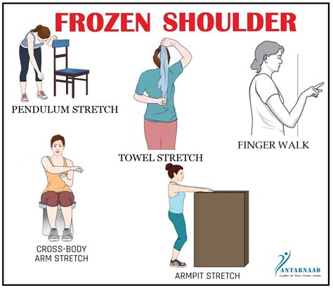 Printable Frozen Shoulder Exercises Pdf