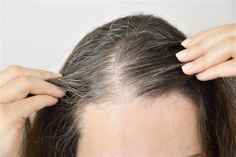 Problem 1: Graue oder dünner werdende Haare