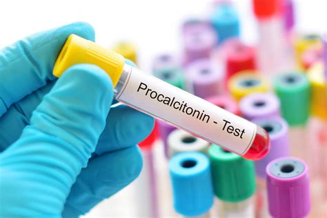 Procalcitonin Testing and Antibiotic Stewardship