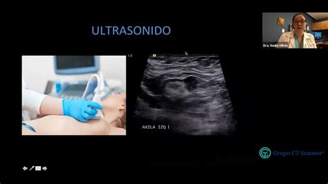 Procedimientos guiados por ultrasonido procedimientos guiados por ultrasonido. - Manual de servicio merlo p26 6.