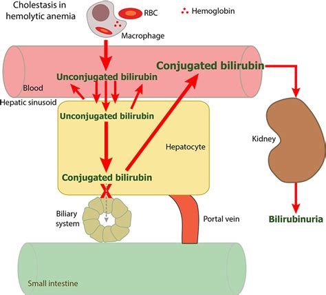 Production of bilirubin with hemolysis – eClinpath