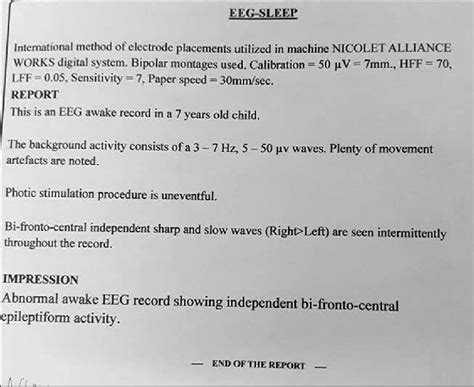 Project Report On EEG Machine PDF Electroencephalography