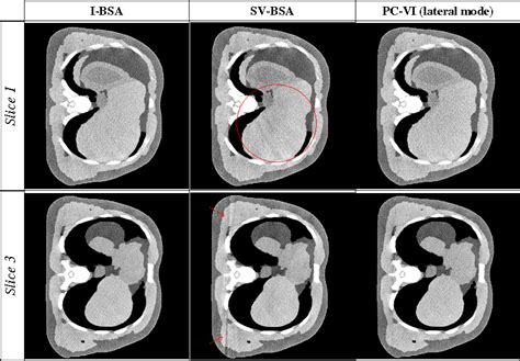 Projection correlation based view interpolation for cone beam CT ...