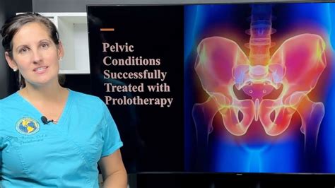 Prolotherapy for Pelvic & Groin Pain – Caring Medical Florida