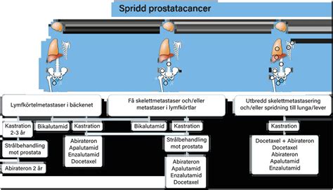 Prostatacancer spridning
