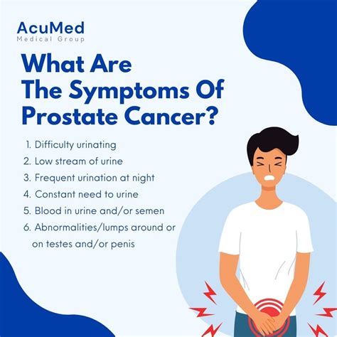 Prostate Onlyfans Leak