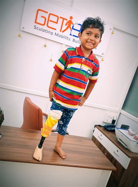 Prosthetic leg in India, Artificial limbs in India, Artificial limb ...