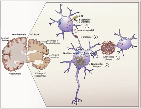 Protein Expression In Down Syndrome Brain