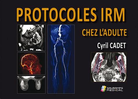 Protocoles Irm Chez L Adulte